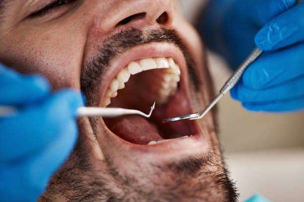 Best Walk-In Emergency Dentist in Florence, TX