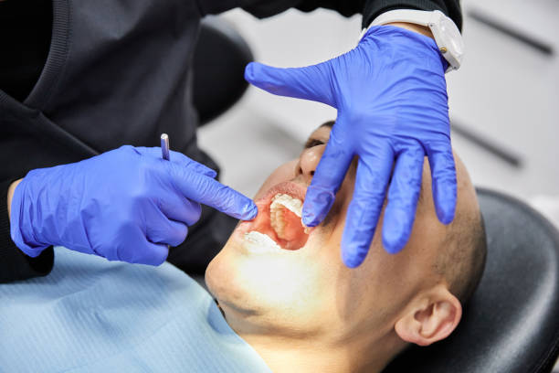 Best Emergency Root Canal Treatment in Florence, TX